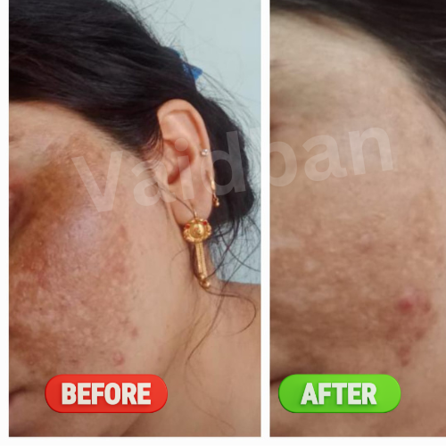 Vaidban Rupanjali AM Oil - 10 ml - Nourishing Day Oil with Ayurvedic Ingredients for Skin Radiance