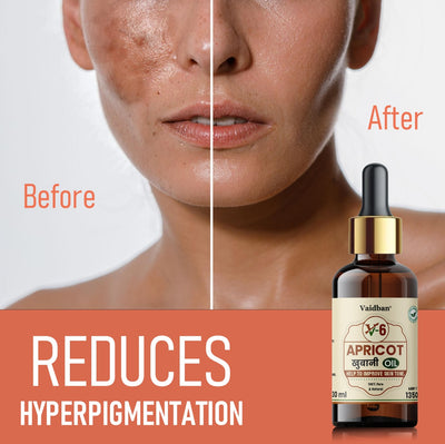 Tan Removal